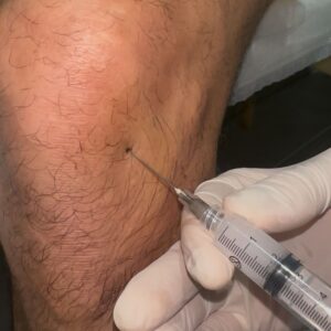CASSIANEREIS-fisioterpia-iturama (33)