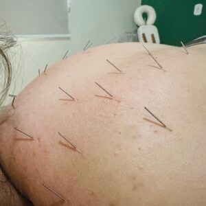 CASSIANEREIS-fisioterpia-iturama (37)